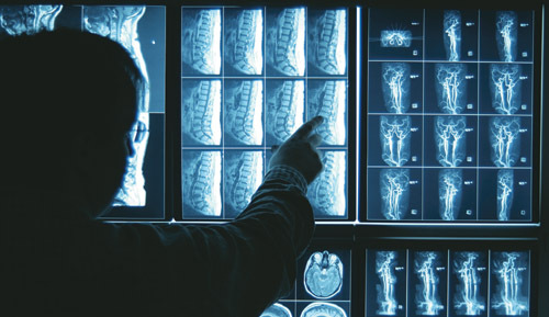 Foto: Ein Mann zeigt auf tomografische Aufnahmen.